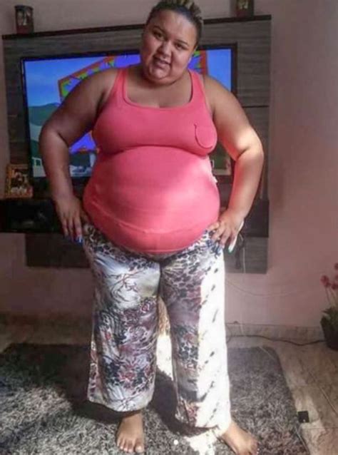 monalisa moura|Formerly obese woman is totally unrecognizable in new photos。